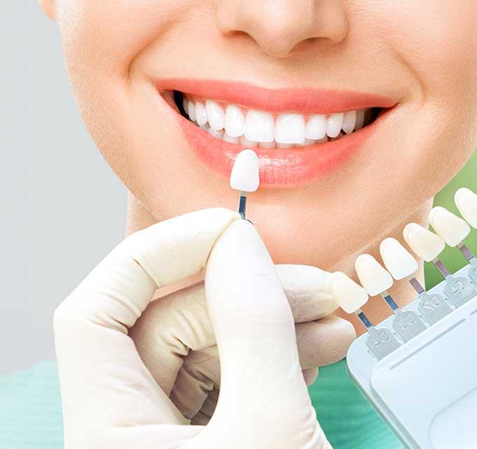 smile design at smaindyo dental care, Thiruvananthapuram (or Trivandrum)
