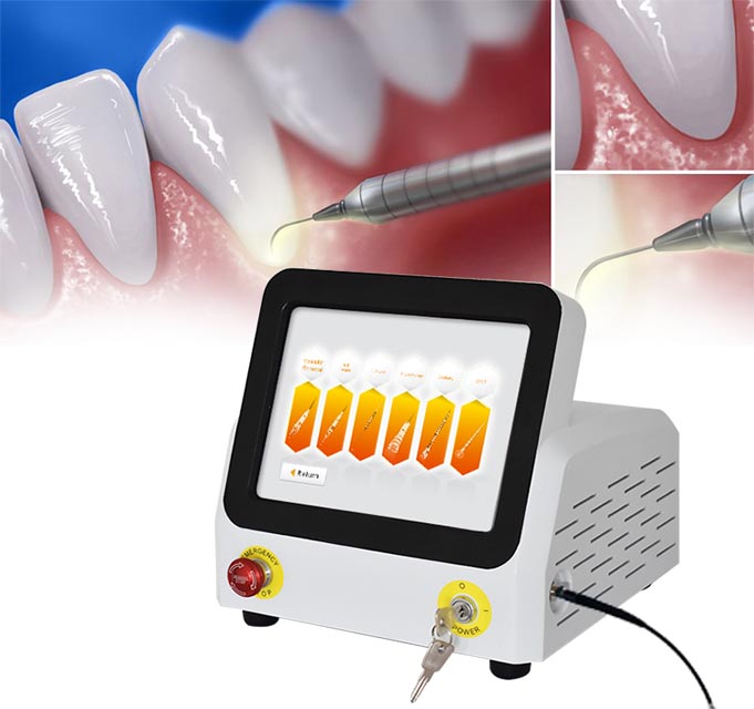 dental laser treatment in nedumangad